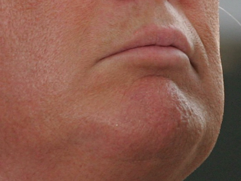 Illustration for article titled A Visual History of Donald Trump's Mouth